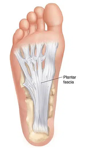 Optimum Care - Heel Pain or plantar fasciitis - Richmond Podiatrist